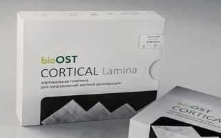 Пластины OsteoBiol Lamina и задачи, решаемые с их помощью в стоматологии