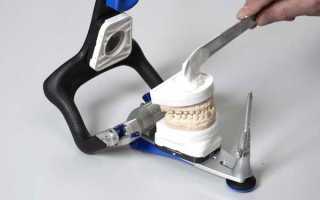 Особенности работы с гипсом в стоматологии