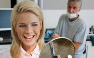 Памятка до и после имплантации зубов или аспекты успешного исхода