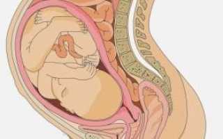 Геморрой при беременности: симптомы, лечение и профилактика