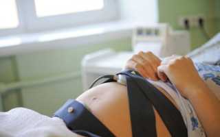 Всё, что нужно знать о третьем скрининге во время беременности