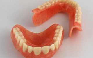 Особенности изготовления съемных зубных протезов и последующей их эксплуатации