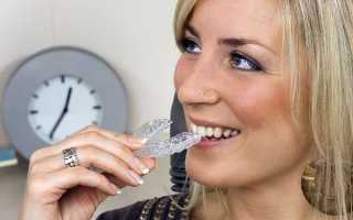Как с помощью сплинт терапии устраняются проблемы ВНЧС в стоматологии?