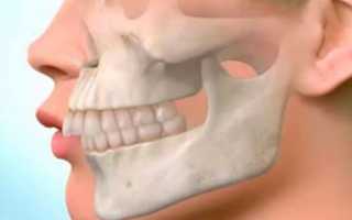 Маленькая нижняя челюсть — косметологический дефект или серьезная патология