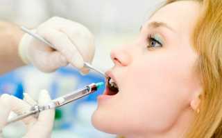 Плазмолифтинг: современная методика в стоматологии