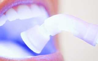 Лазерное отбеливание зубов: отзывы, описание, стоимость