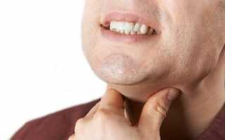 Четыре провокатора появления аллергии на зубные протезы