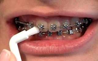 Как устроена монопучковая зубная щетка