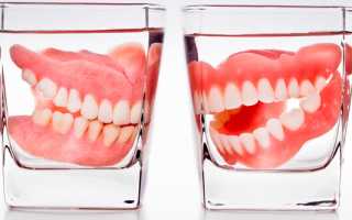 Правильный уход за съемными зубными протезами
