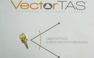 Микроимпланты Vector Tas для комфортного ортодонтического лечения