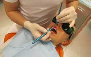 Лазерная имплантация зубов – инновационный подход к восстановлению элементов ряда