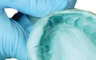Ксантальгин – альгинатный материал для создания точного отпечатка тканей протезного ложа