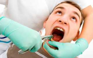 А вы уже слышали об удалении зубов на дому?
