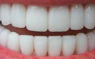 Металлокерамические коронки на передние зубы: плюсы и минусы
