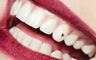 Стразы на зубы – все о популярном тренде
