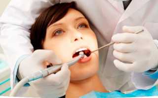 Гемисекция зуба – что это такое и для чего проводится?