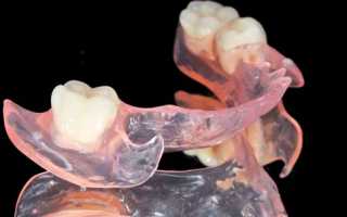Какой съемный зубной протез при частичном отсутствии зубов лучше выбрать