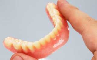 Нейлоновые зубные протезы: отзывы, плюсы и минусы, виды