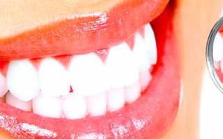 Чем безопасно отбелить зубы в домашних условиях