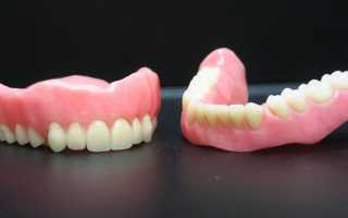 Виды базисов зубных протезов и их значимость в ортопедической стоматологии