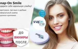 Насколько эффективно виниры Snap On Smile решают проблемы дефектов зубного ряда
