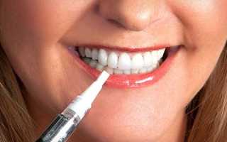 Карандаш для отбеливания зубов – отзывы стоматологов о популярных видах