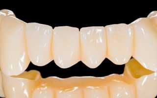 Пластмассовые коронки на передние зубы: отзывы и цены