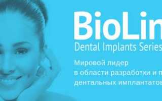 Импланты Bioline – немецкий подход к созданию надежной и долговечной конструкции