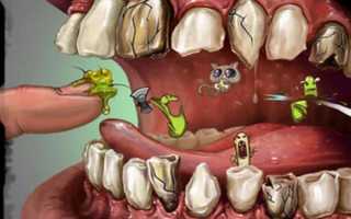Виды патологий, развивающихся вследствие инфекции зубов и современные способы лечения