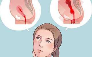 Сгустки крови в матке после родов и кесарева сечения: что делать