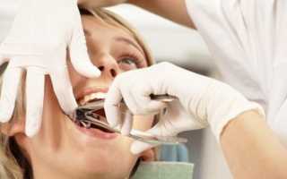 Тонкости удаления подвижных зубов без последствий