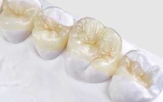 Эффективность реставрации разрушенного зуба керамической вкладкой