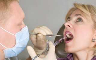 Карпульная анестезия ― что это такое и когда оправдано применение в стоматологии