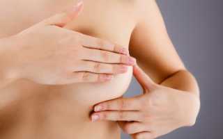 Перетягивание груди для прекращения лактации