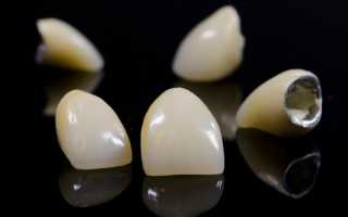 Как часто требуется замена зубных коронок или показания к перепротезированию