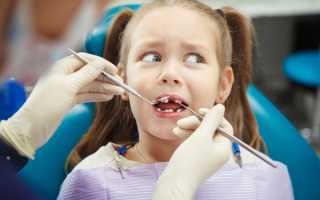 Можно ли проводить имплантацию зубов детям