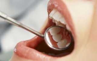 Санация полости рта: что это такое и как осуществляется