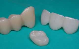 Популярно о тонкостях восполнения пробелов в челюстном ряду пластмассовыми мостовидными протезами