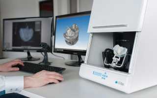 Назначение и особенности применения CAD CAM систем в ортопедической стоматологии