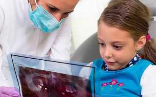 Когда ребенку нужен врач-ортодонт