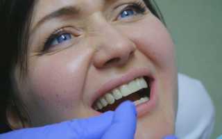 Веские основания для снятия коронки с зуба и современные методы проведения манипуляции