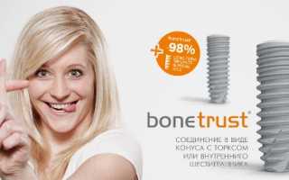 За имплантами BoneTrust будущее современной ортопедической стоматологии?