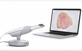 Что такое сканер 3Shape TRIOS и его значимость в современной стоматологии