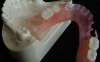 Что важно знать о зубных протезах Flexite