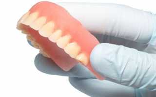 Покрывные зубные протезы – полный обзор