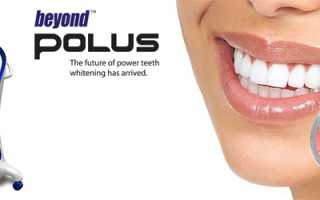 Сияющая улыбка от системы отбеливания зубов Beyond