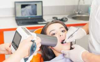 Можно ли лечить зубы при грудном вскармливании