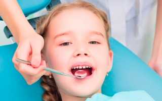 Зачем делать ребенку серебрение молочных зубов