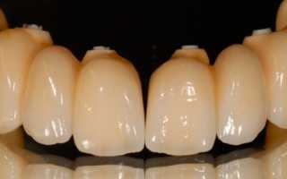 Циркониевые коронки на передние зубы: отзывы, стоимость, описание