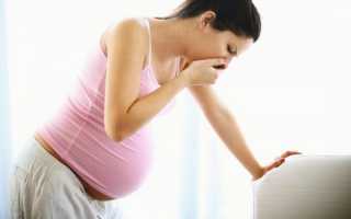 Изжога во время беременности, лечение и профилактика